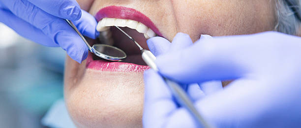 Professional Emergency Dental Service in CA
